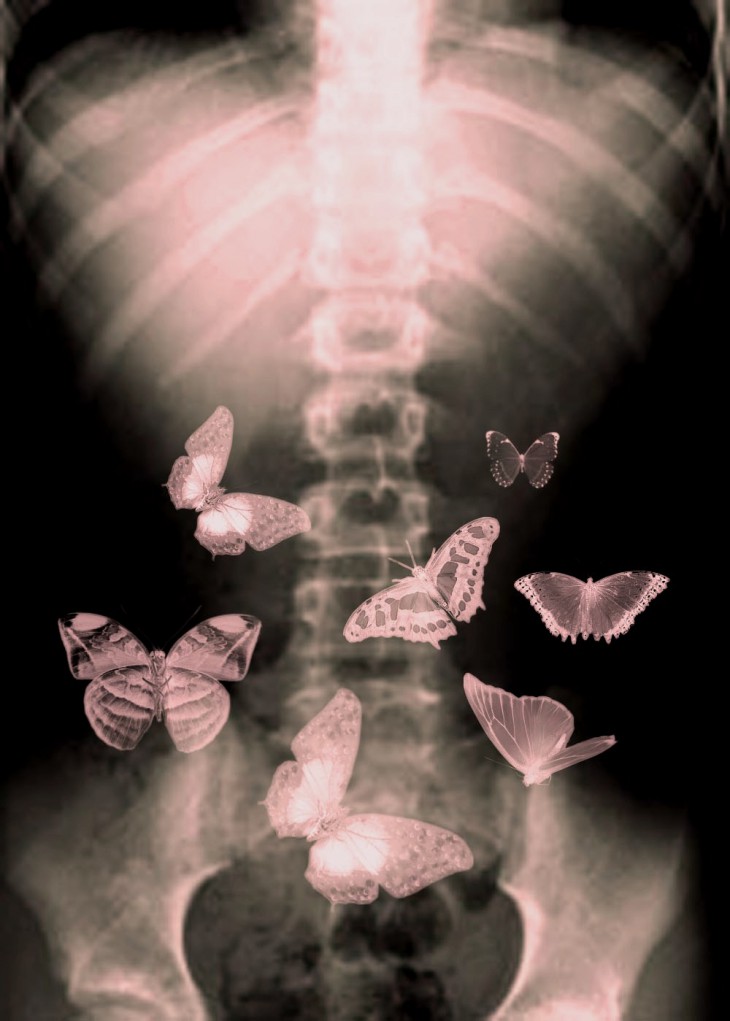 Опен кидс- - в животе снова эти бабочки 