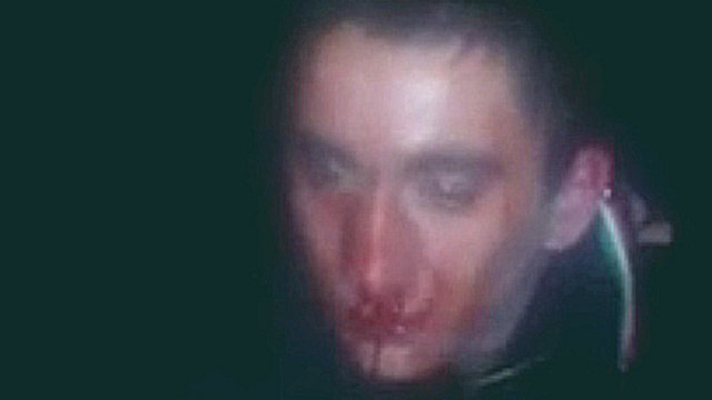 Репост!!! Фашисты издевательски избили парня в Донецке 