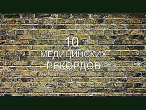 10 МЕДИЦИНСКИХ РЕКОРДОВ 